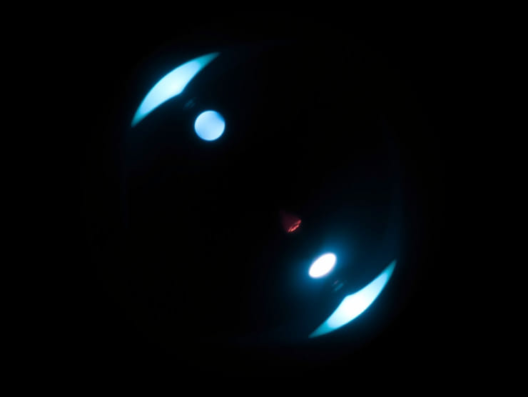 Left Posterior Vitreous Detachment