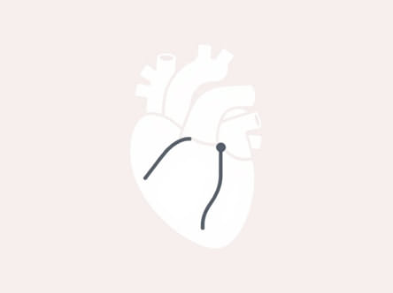 Left Ventricular Prominence Suggestive Of Enlargement