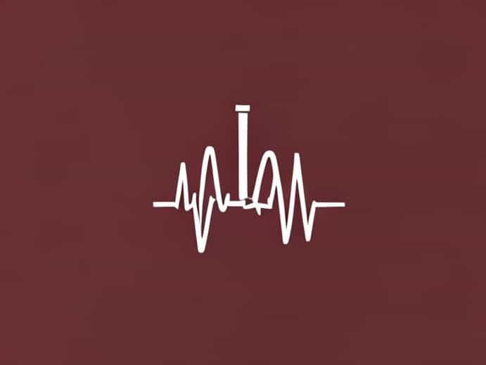 Ecg Of Stable Angina