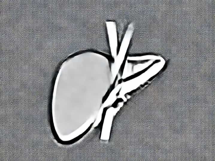 Adrenal Cortex Embryological Origin