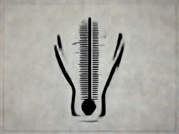 Arthritis Barometric Pressure Chart