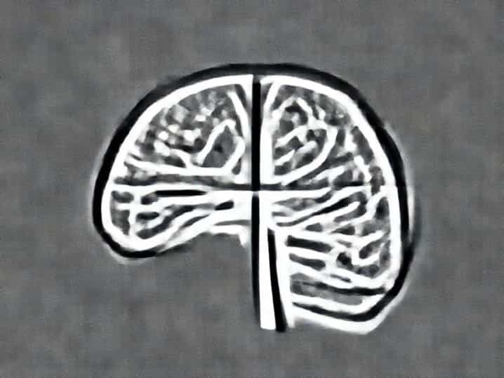 Vestibular Thalamo Cortical Pathway