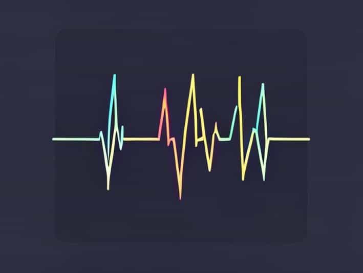 What Does Aflutter Look Like On Ecg