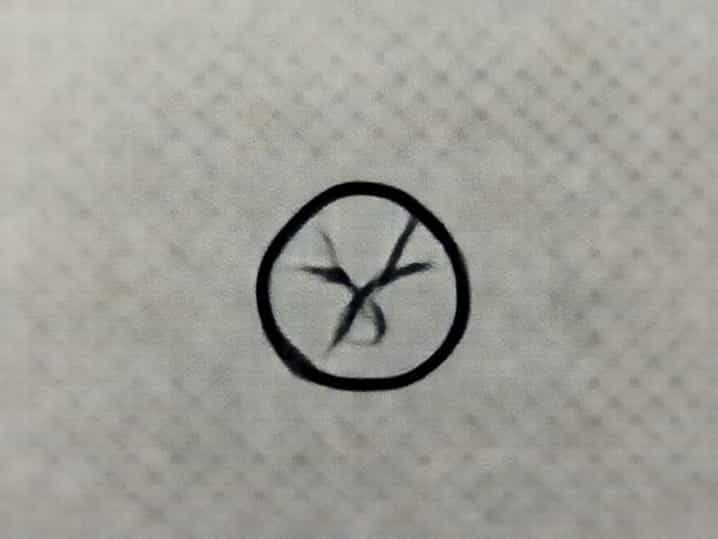 Zoledronic Acid Parathyroid Hormone